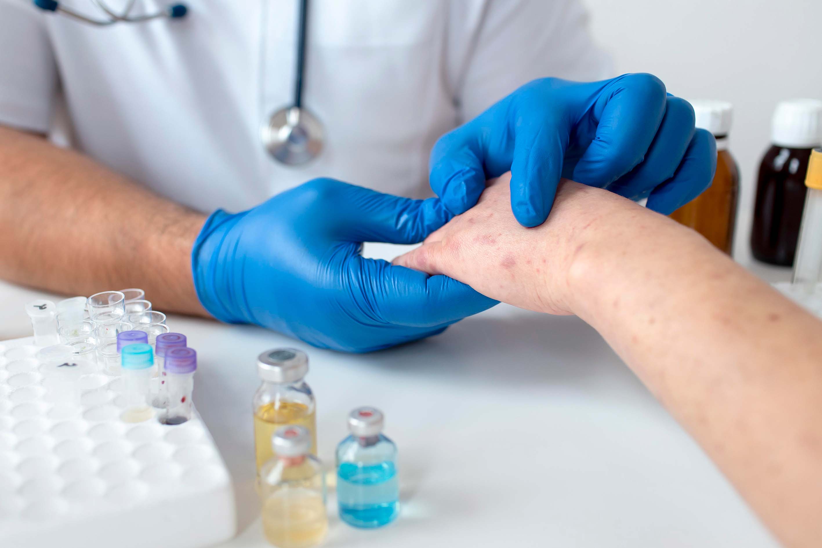 Dermatolojik Tedavi Yöntemleri Nelerdir?